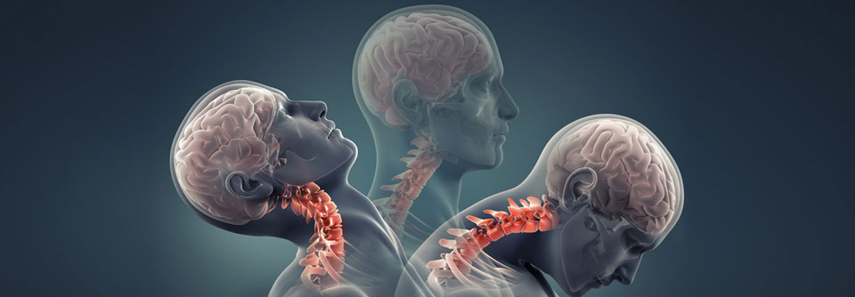 Durch die ruckartigen Kopfbewegungen kann es langfristig zu Schäden an der Wirbelsäule kommen.