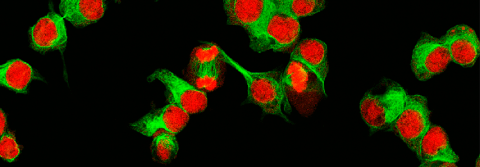 Bereits in vorangegangenen Studien wurden gegen GD2 gerichtete CAR-T-Zellen bei Personen mit Neuroblastom geprüft.