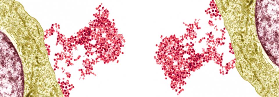 Epstein-Barr-Viren (rot) werden von einer B-Zelle abgesondert (Transmissionselektronenmikroskopie).