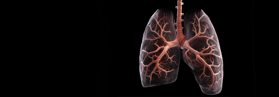 Eine pulmonale Hypertonie belastet Patienten mit einer chronischen Lungenerkrankung zusätzlich.