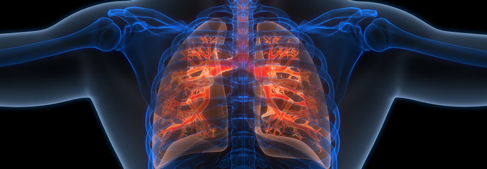 Bei einer fibroisierenden ILD kommt es u.a. zu Vernarbungen des Lungengewebes.
