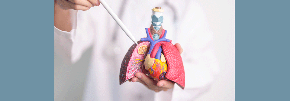 NSCLC mit METex14-Mutation spricht gut auf Capmatinib an, besonders bei älteren, polymorbiden Patienten.