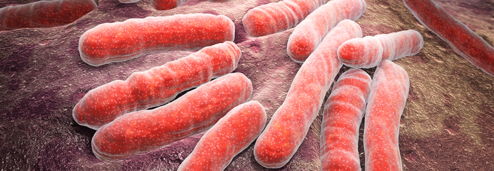 Die derzeit offiziell propagierte Therapie der medikamentenresistenten Tuberkulose ist langwierig und zu selten von Erfolg gekrönt. 