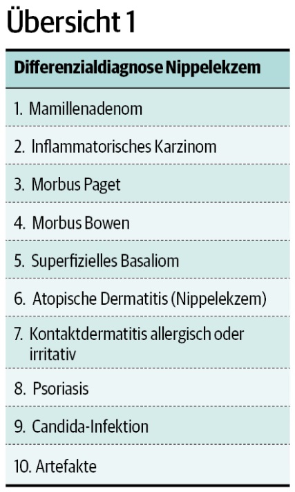 Übersicht 1: Differenzialdiagnose Nippelekzem.