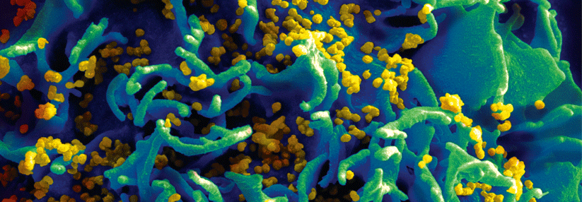 Mit einem Rasterelektronenmikroskop kann man sehen, wie die Viren in eine T-Zelle eindringen.