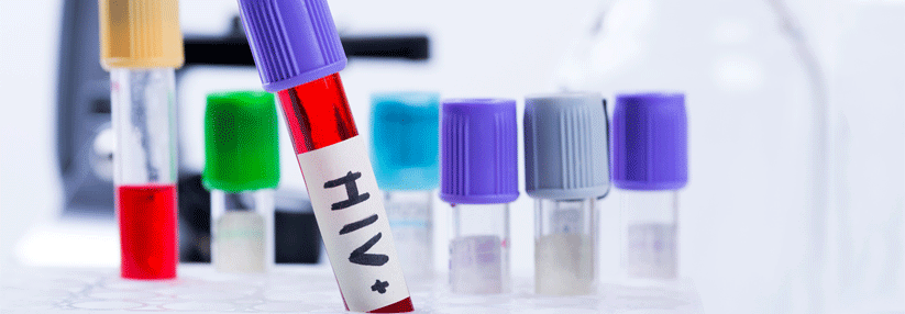 Mit HIV-Tests für zu Hause sollen Menschen erreicht werden, die bisher durchs Raster gefallen sind.