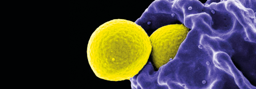 Staphylokokken (gelb) treiben so lange ihr Unwesen, bis sie z.B. von einem Granulozyten (lila) verschlungen werden.