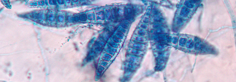 Microsporum canis dominiert unter den Erregern, die eine Tinea capitis verursachen.
