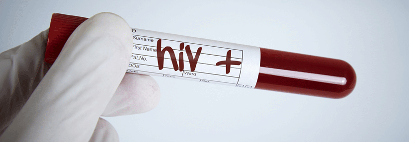 Wie hoch ist das Übertragungsrisiko von HIV unter einer Therapie wirklich?