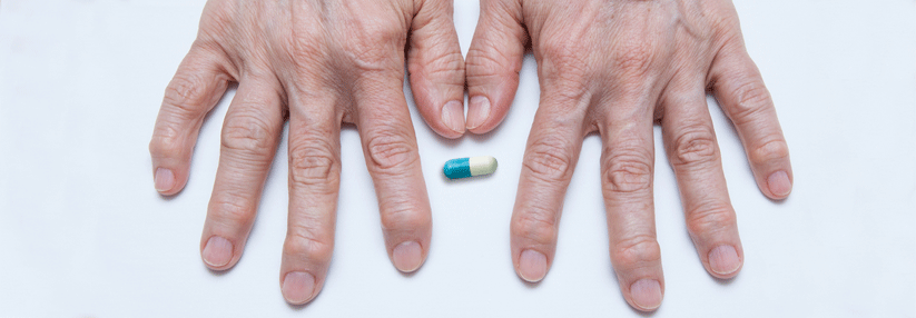 Abatacept wurde bei der Therapie der rheumatoiden Arthritis früher wieder abgesetzt als Rituximab und Tocilizumab.