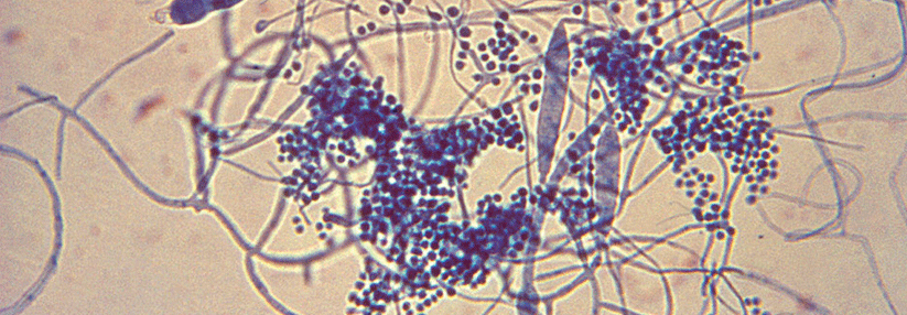 Trichophyton mentagrophytes ernährt sich wie alle Dermatophyten von Keratinen. Er bildet trauben- und zigarrenförmige Sporen.