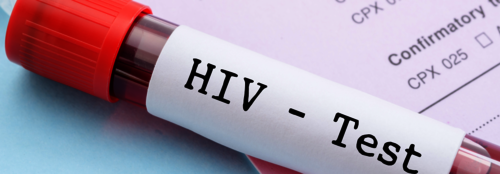 Potenziell mit HIV infiziert