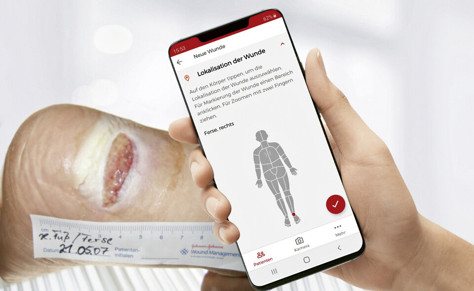 Die WundDoku App ist einfach bedienbar, datenschutzkonform und funktioniert auch ohne Internetzugang.