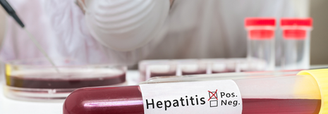 Hepatitis B