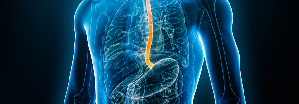 Eine histologische Remission zeigten nach 24 Wochen 87,4 % der Teilnehmerinnen und Teilnehmer unter Benralizumab, unter Placebo waren es 6,5 %.